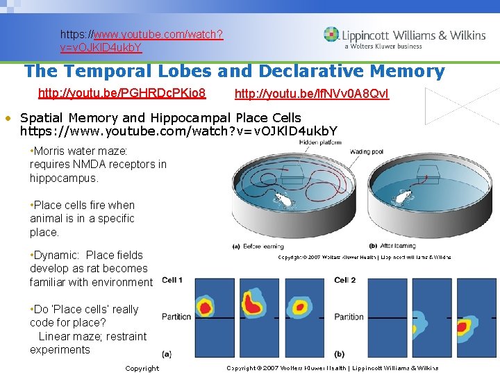 https: //www. youtube. com/watch? v=v. OJKl. D 4 ukb. Y The Temporal Lobes and