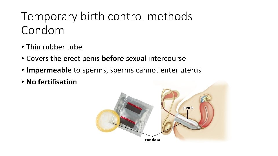 Temporary birth control methods Condom • Thin rubber tube • Covers the erect penis