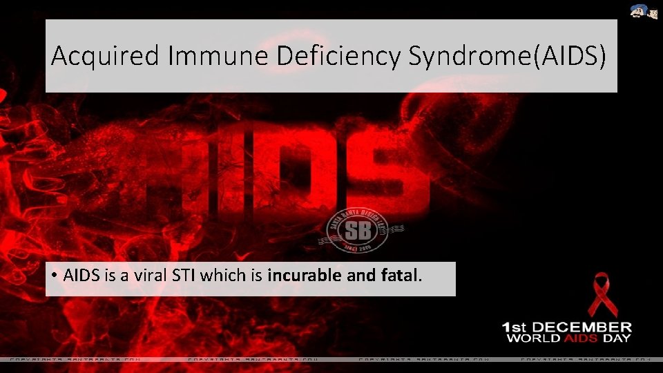 Acquired Immune Deficiency Syndrome(AIDS) • AIDS is a viral STI which is incurable and