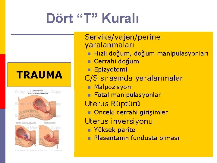 Dört “T” Kuralı TONUS p Serviks/vajen/perine Uterusun kasılmasında güçsüzlük yaralanmaları (Atoni) n n TRAUMA