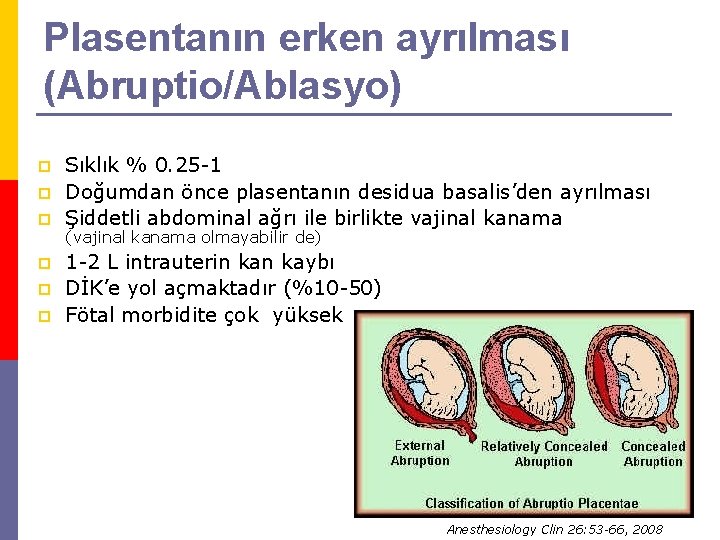 Plasentanın erken ayrılması (Abruptio/Ablasyo) p p p Sıklık % 0. 25 -1 Doğumdan önce