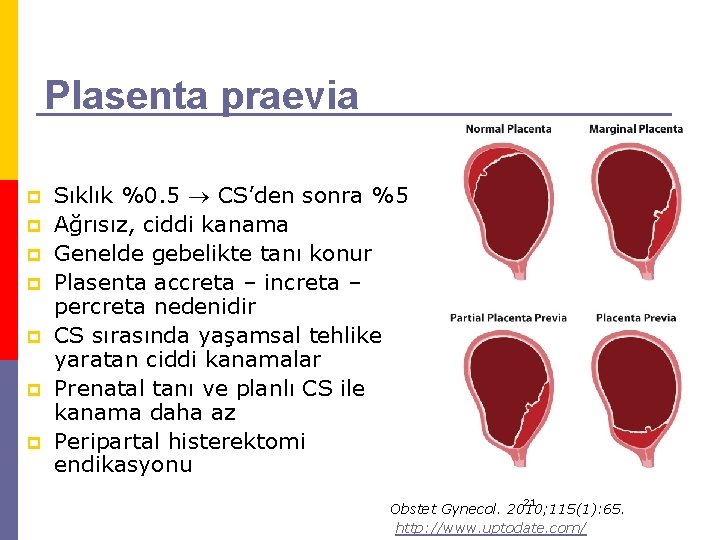 Plasenta praevia p p p p Sıklık %0. 5 CS’den sonra %5 Ağrısız, ciddi