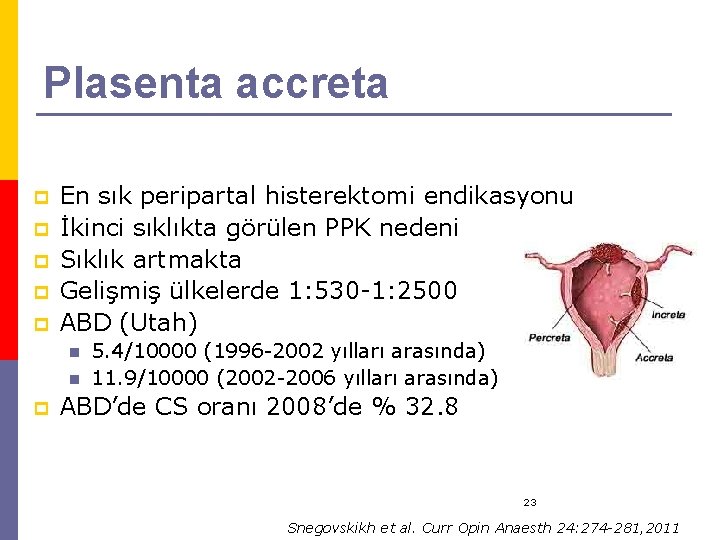 Plasenta accreta p p p En sık peripartal histerektomi endikasyonu İkinci sıklıkta görülen PPK