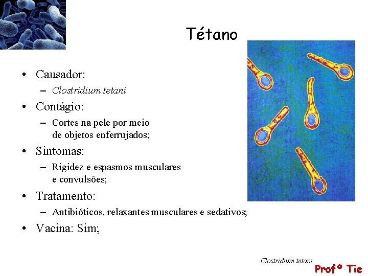 Tétano • Causador: – Clostridium tetani • Contágio: – Cortes na pele por meio