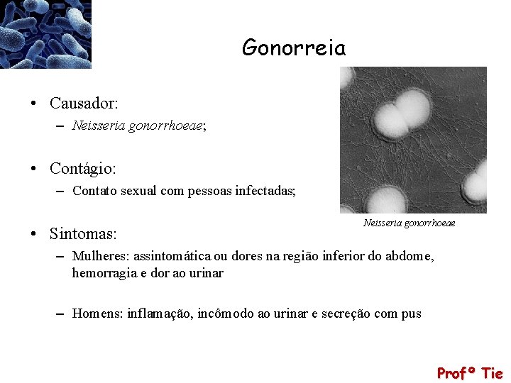 Gonorreia • Causador: – Neisseria gonorrhoeae; • Contágio: – Contato sexual com pessoas infectadas;