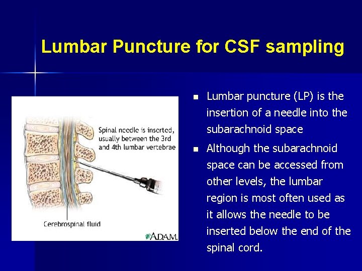 Lumbar Puncture for CSF sampling n Lumbar puncture (LP) is the insertion of a