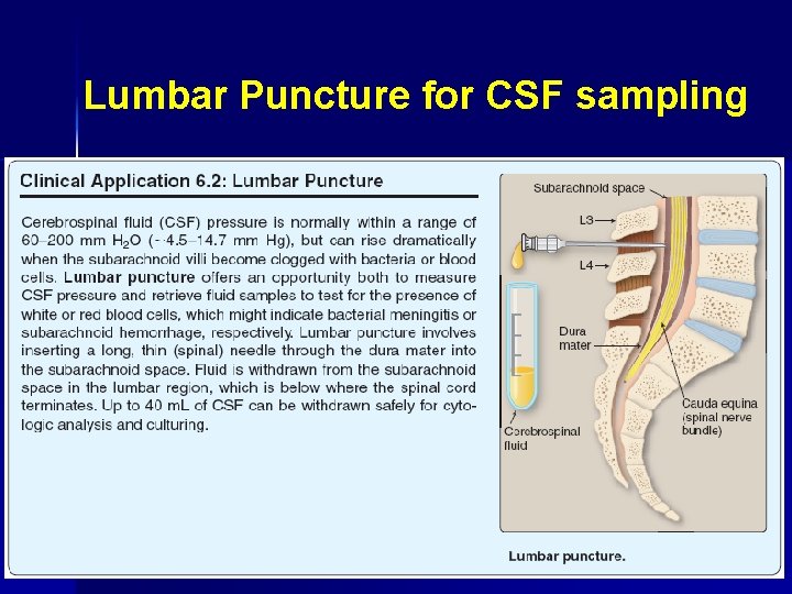 Lumbar Puncture for CSF sampling 