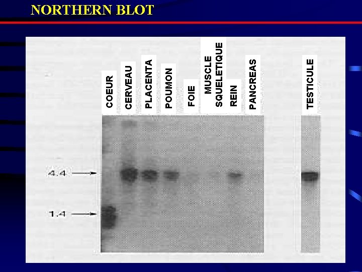 TESTICULE PANCREAS REIN MUSCLE SQUELETIQUE FOIE POUMON PLACENTA CERVEAU COEUR NORTHERN BLOT 