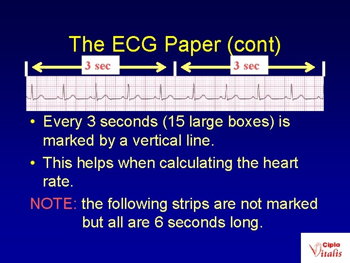 The ECG Paper (cont) 3 sec • Every 3 seconds (15 large boxes) is
