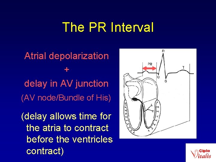 The PR Interval Atrial depolarization + delay in AV junction (AV node/Bundle of His)