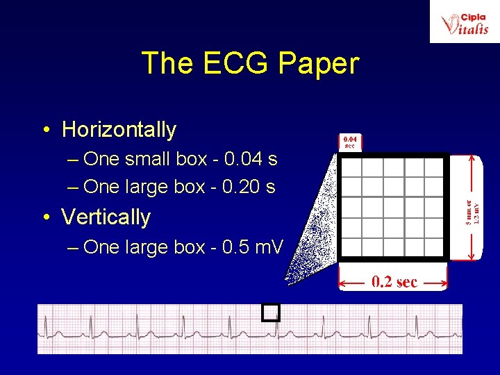 The ECG Paper • Horizontally – One small box - 0. 04 s –