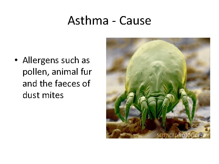 Asthma - Cause • Allergens such as pollen, animal fur and the faeces of