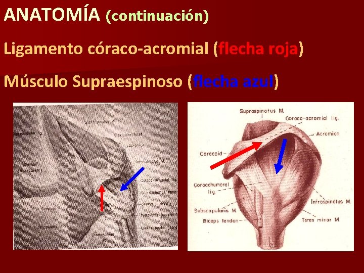 ANATOMÍA (continuación) Ligamento córaco-acromial (flecha roja) Músculo Supraespinoso (flecha azul) 