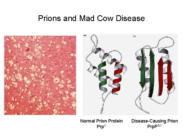 Prions and Mad Cow Disease Normal Prion Protein Prp. C Disease-Causing Prion Prp. PSC