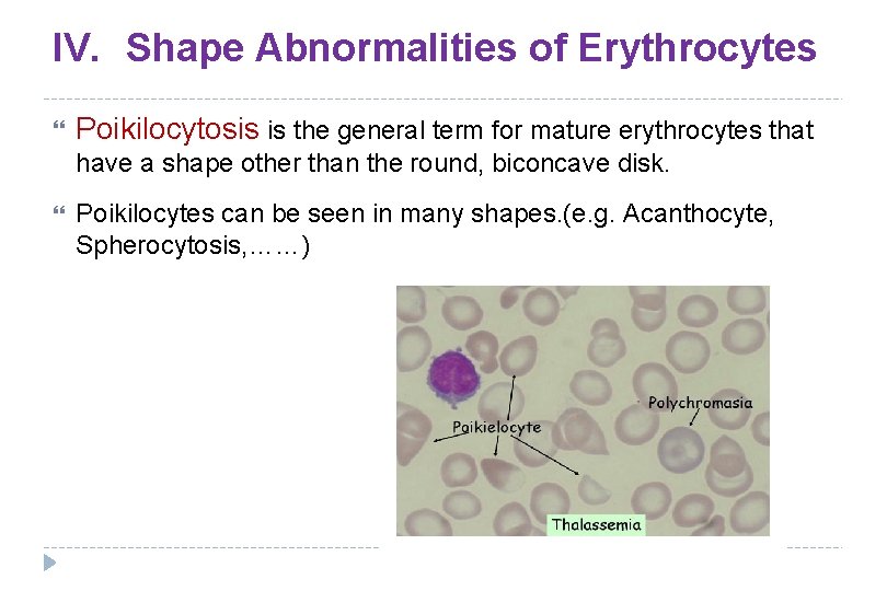 IV. Shape Abnormalities of Erythrocytes Poikilocytosis is the general term for mature erythrocytes that