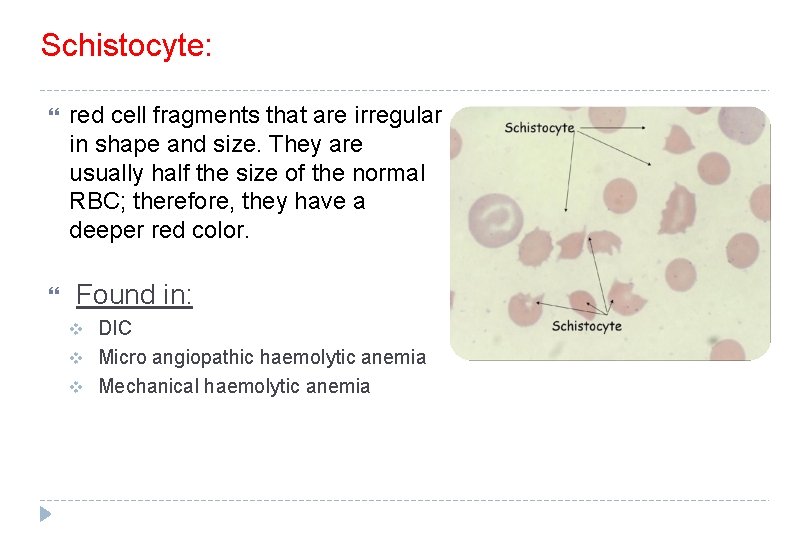 Schistocyte: red cell fragments that are irregular in shape and size. They are usually