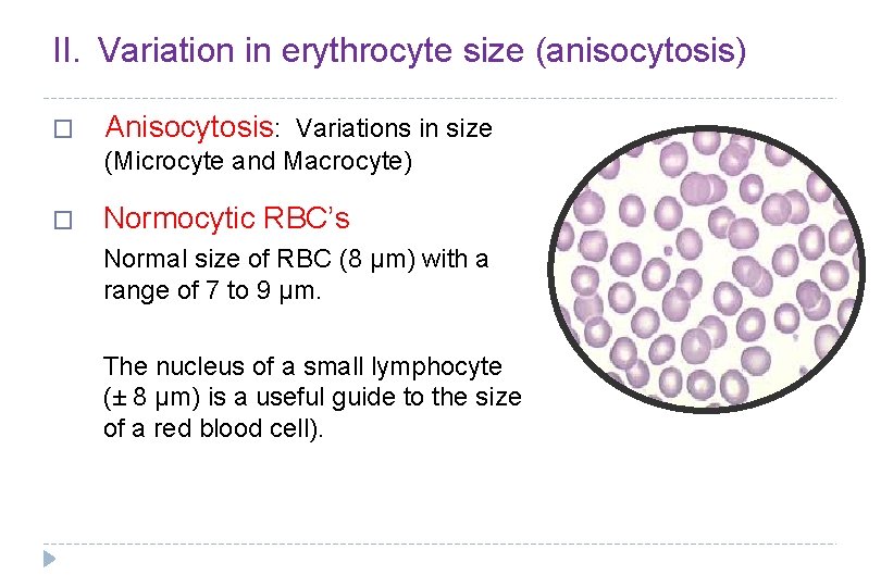 II. Variation in erythrocyte size (anisocytosis) � Anisocytosis: Variations in size (Microcyte and Macrocyte)