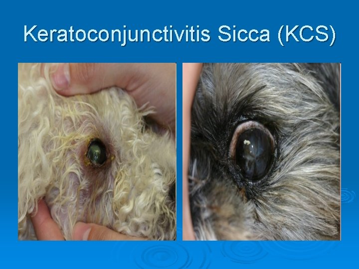 Keratoconjunctivitis Sicca (KCS) 
