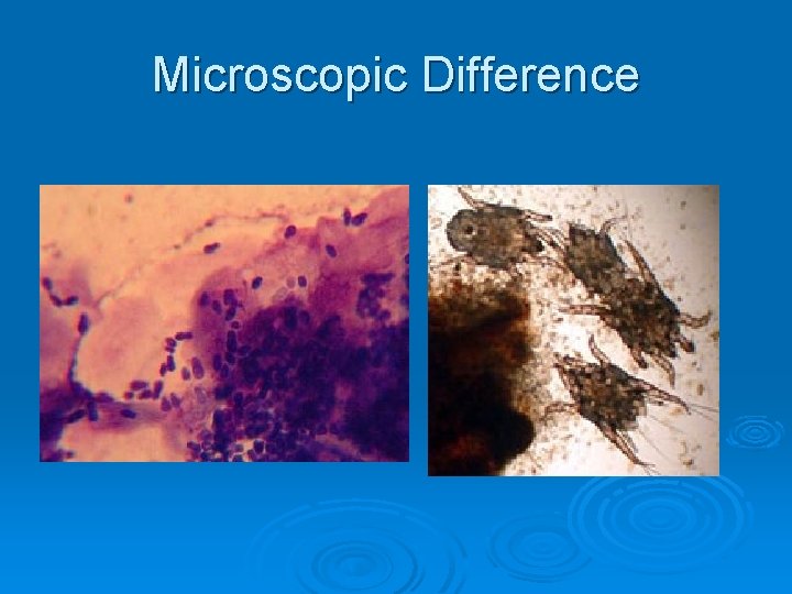 Microscopic Difference 