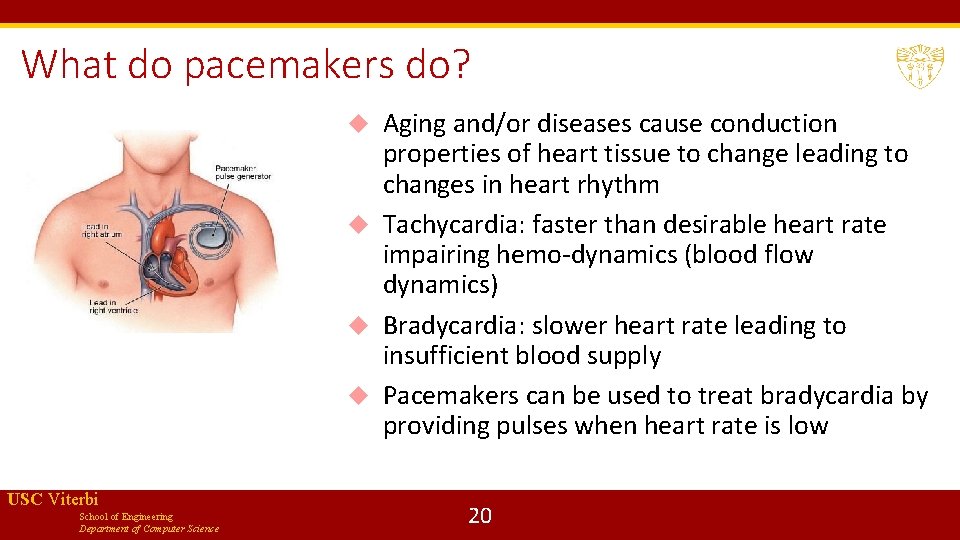 What do pacemakers do? Aging and/or diseases cause conduction properties of heart tissue to