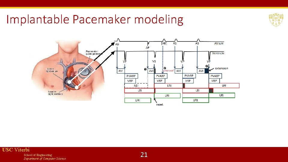 Implantable Pacemaker modeling USC Viterbi School of Engineering Department of Computer Science 21 