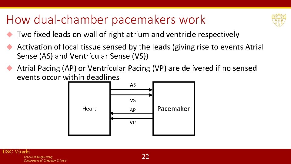 How dual-chamber pacemakers work Two fixed leads on wall of right atrium and ventricle