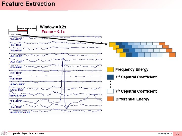 Feature Extraction S. López de Diego: Abnormal EEGs June 29, 2017 30 