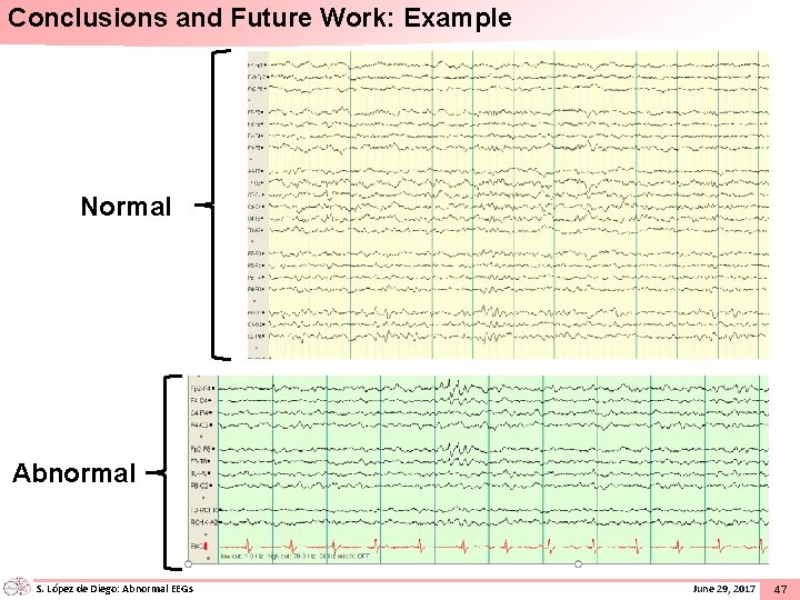 Conclusions and Future Work: Example Normal Abnormal S. López de Diego: Abnormal EEGs June