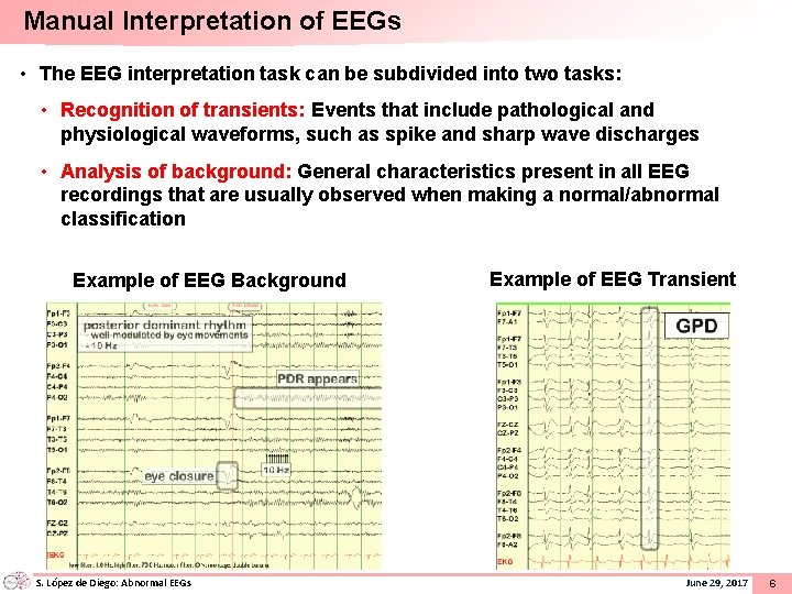 Manual Interpretation of EEGs • The EEG interpretation task can be subdivided into two