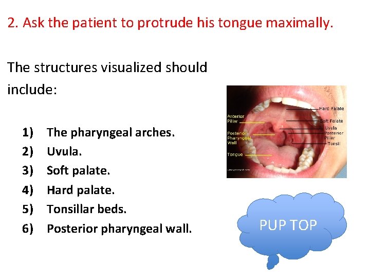 2. Ask the patient to protrude his tongue maximally. The structures visualized should include: