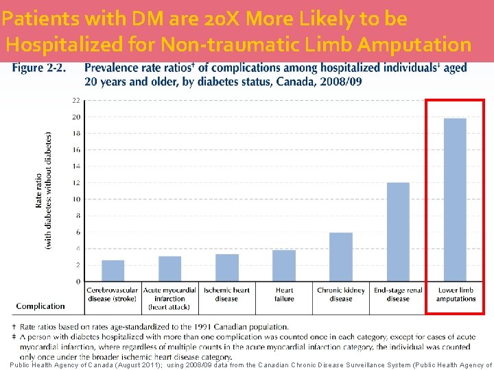 Patients with DM are 20 X More Likely to be Hospitalized for Non-traumatic Limb