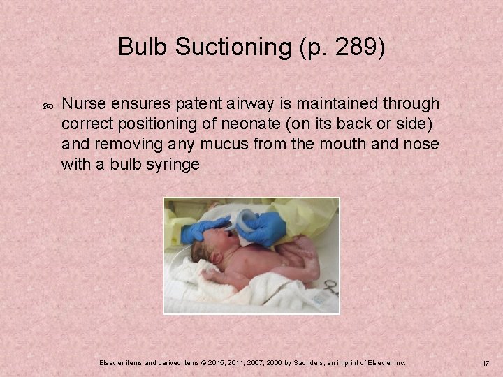 Bulb Suctioning (p. 289) Nurse ensures patent airway is maintained through correct positioning of