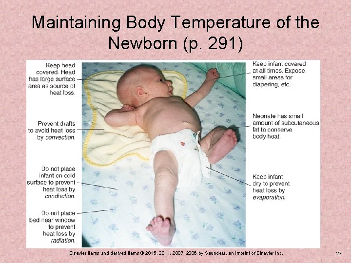 Maintaining Body Temperature of the Newborn (p. 291) Elsevier items and derived items ©