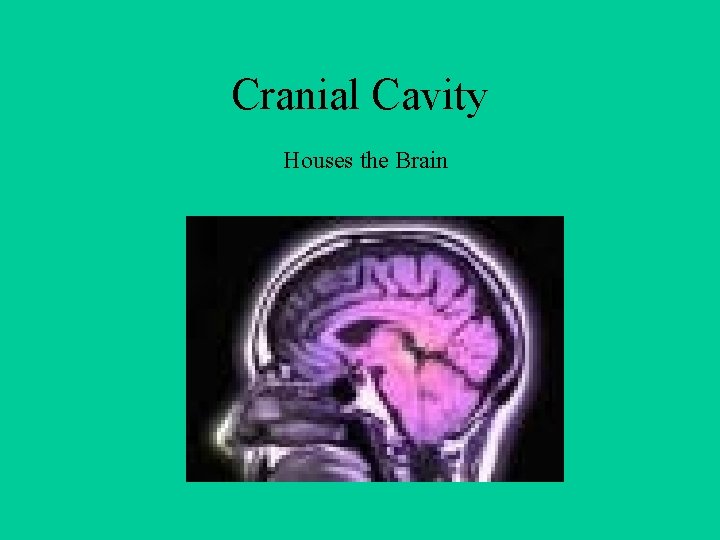 Cranial Cavity Houses the Brain 
