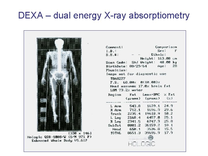 DEXA – dual energy X-ray absorptiometry 