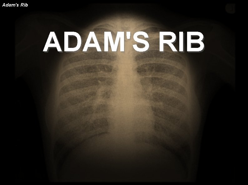 Adam's Rib ADAM'S RIB 
