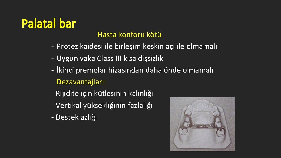 Palatal bar Hasta konforu kötü - Protez kaidesi ile birleşim keskin açı ile olmamalı