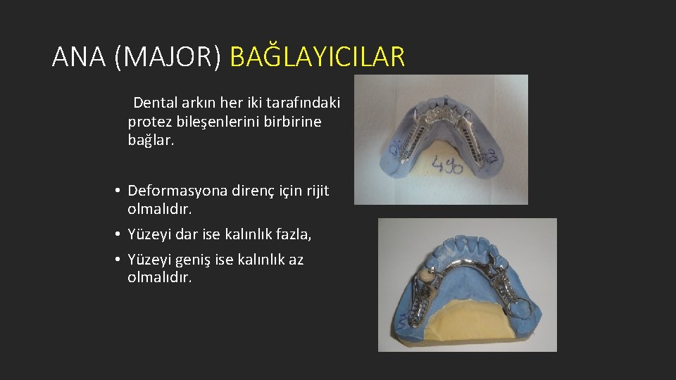 ANA (MAJOR) BAĞLAYICILAR Dental arkın her iki tarafındaki protez bileşenlerini birbirine bağlar. • Deformasyona