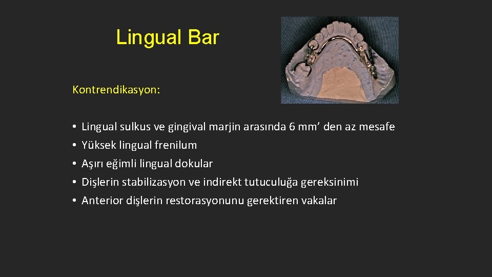 Lingual Bar Kontrendikasyon: • • • Lingual sulkus ve gingival marjin arasında 6 mm’