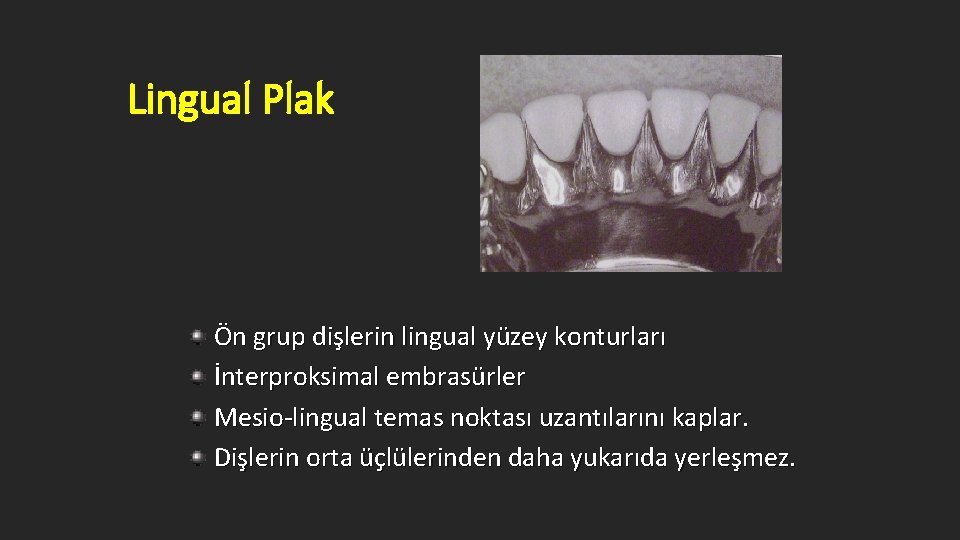 Lingual Plak Ön grup dişlerin lingual yüzey konturları İnterproksimal embrasürler Mesio-lingual temas noktası uzantılarını