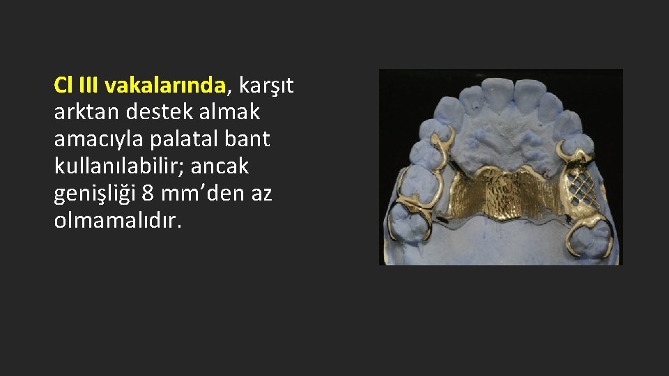 Cl III vakalarında, karşıt arktan destek almak amacıyla palatal bant kullanılabilir; ancak genişliği 8