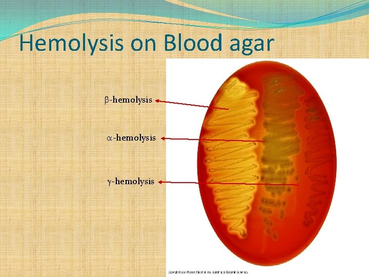 Hemolysis on Blood agar -hemolysis 