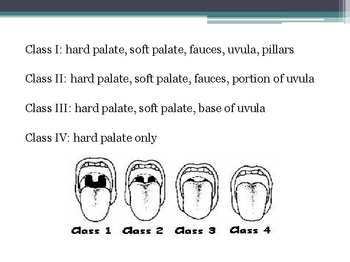 Class I: hard palate, soft palate, fauces, uvula, pillars Class II: hard palate, soft