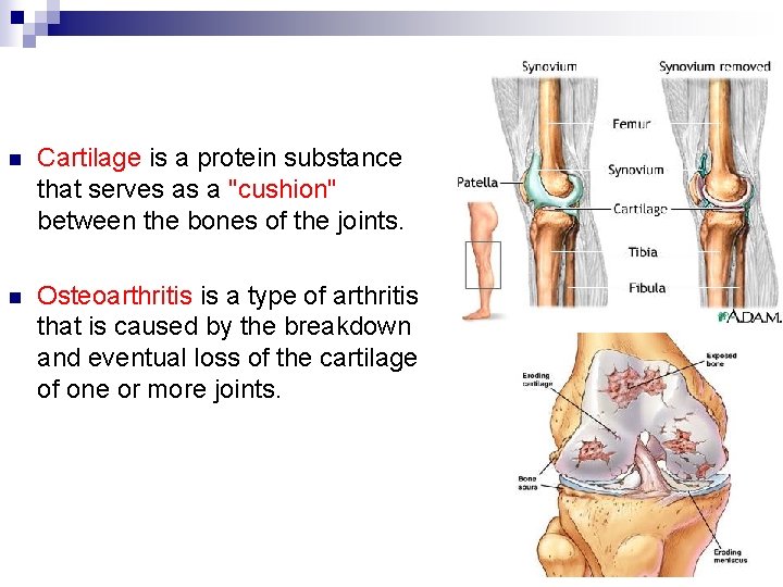 n Cartilage is a protein substance that serves as a "cushion" between the bones