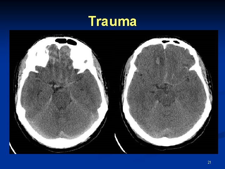 Trauma 21 