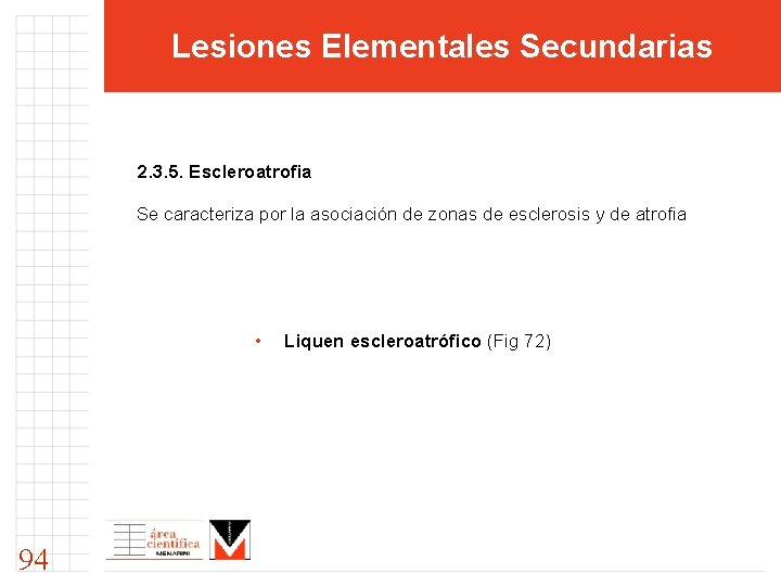 Lesiones Elementales Secundarias 2. 3. 5. Escleroatrofia Se caracteriza por la asociación de zonas