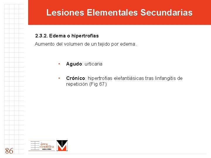 Lesiones Elementales Secundarias 2. 3. 2. Edema o hipertrofias Aumento del volumen de un