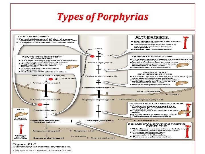 Types of Porphyrias 