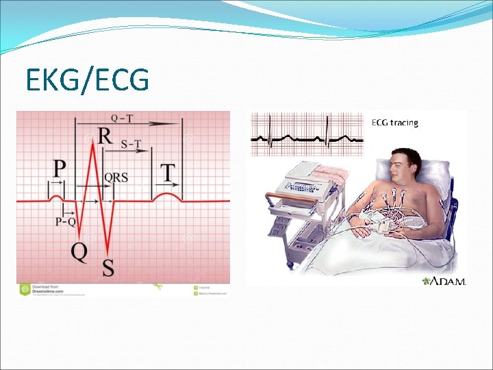 EKG/ECG 