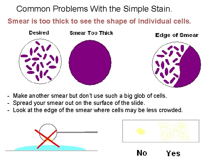 Common Problems With the Simple Stain. Smear is too thick to see the shape